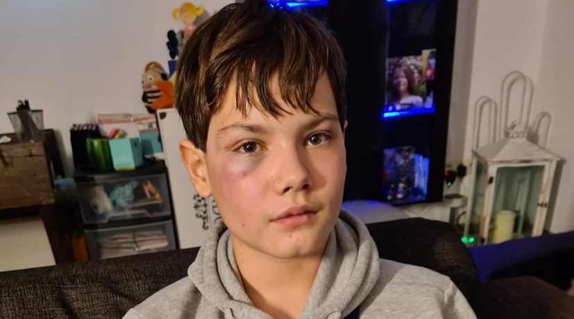 Mauro (12) in Mechelen in elkaar geslagen door jonge allochtoon