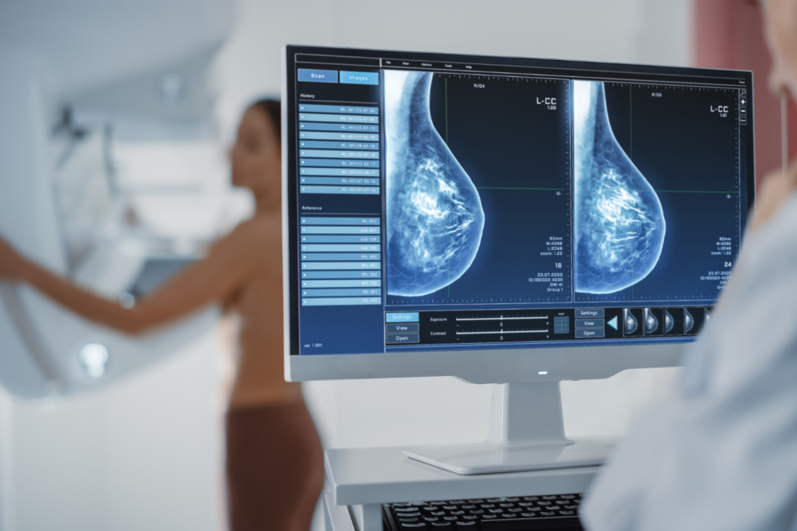 Franse vrouw annuleert mammografie omdat dokter man blijkt te zijn: "Verbied mannen dat beroep nog uit te oefenen"