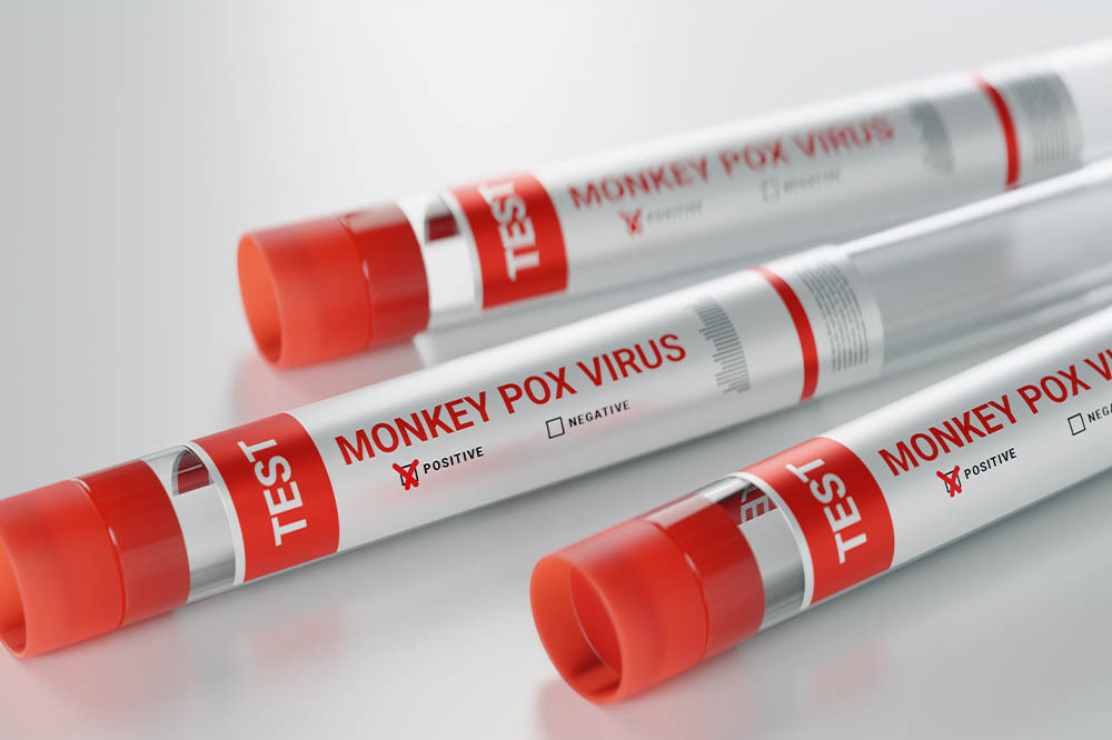 Wereldgezondheidsorganisatie vindt 'apenpokken' een racistische naam en schakelt over op 'mpox'